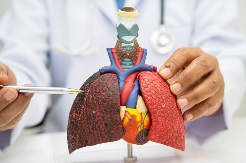 Tumores de pulmon y mediastino en CDMX